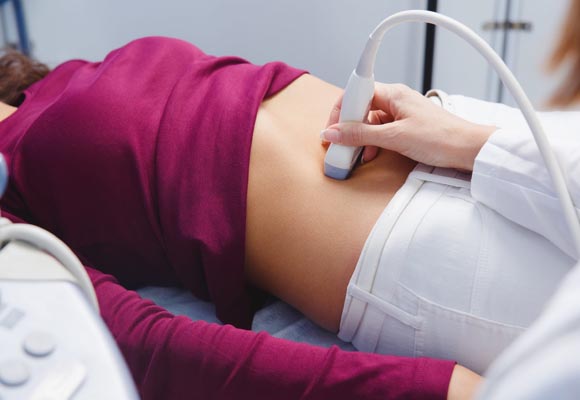 como-vivir-sindrome-ovario-poliquistico-mitos7