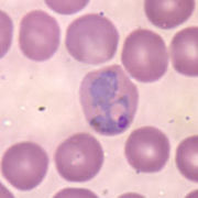 protozoario
